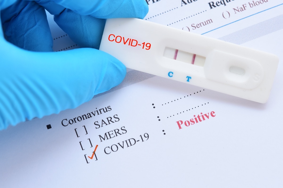 Positive test result by using rapid test device for COVID-19, novel coronavirus 2019