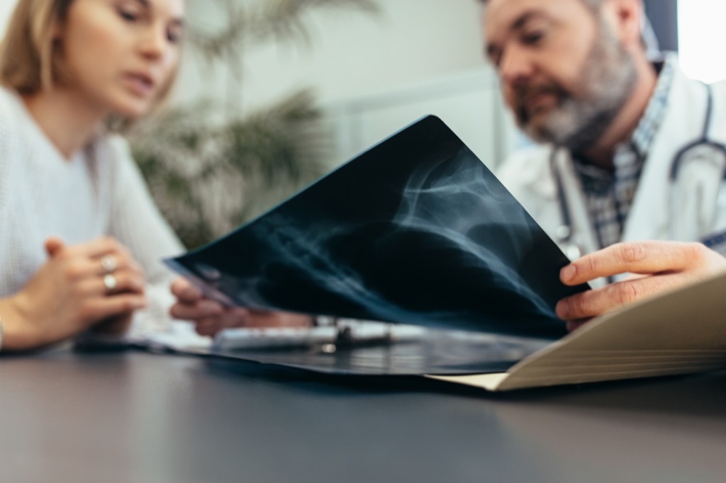 doctors looking at an x-ray and going over medical terminology