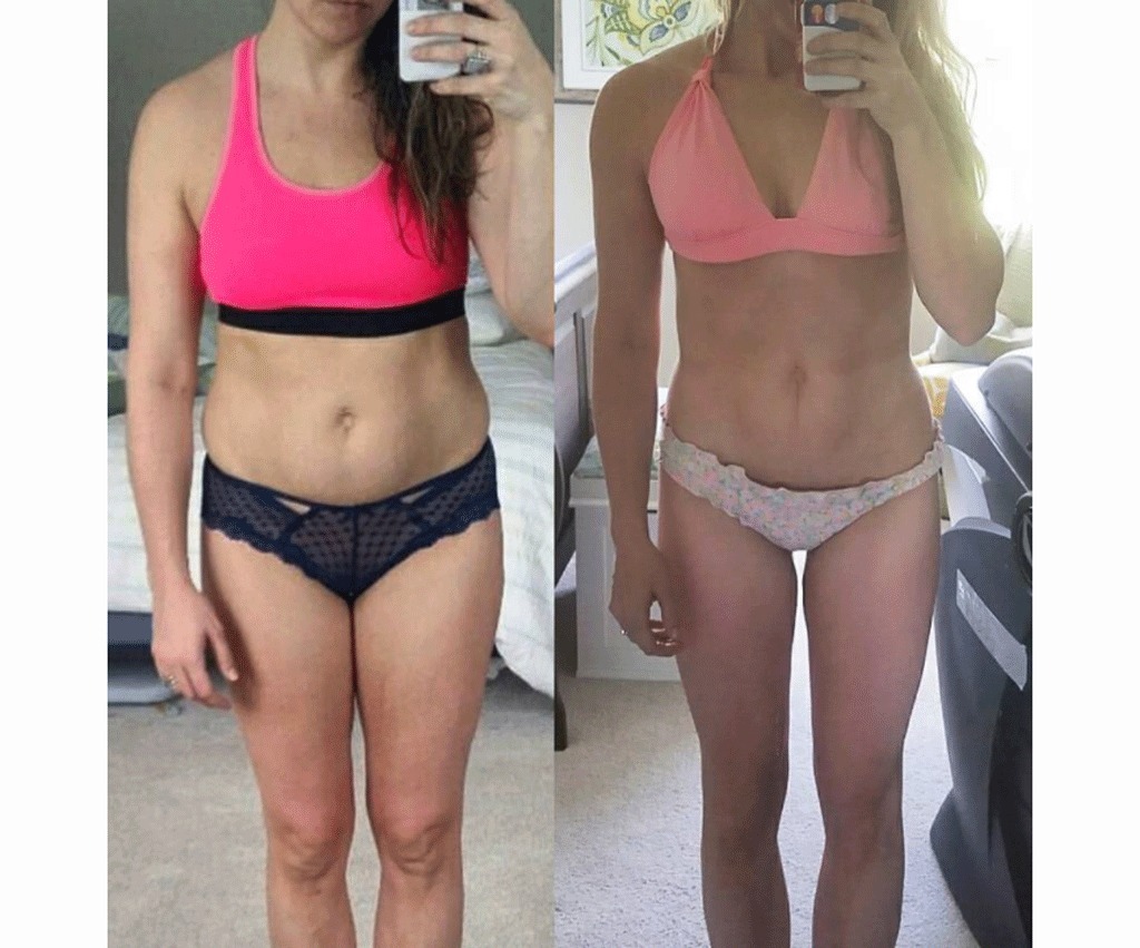 Bbg girl weight loss before and after instagram