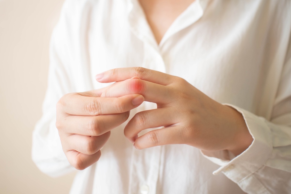 woman holding the joint of her middle finger, which glows red to indicate pain