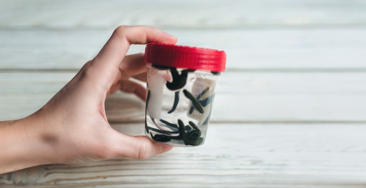 Leeches in a small jar