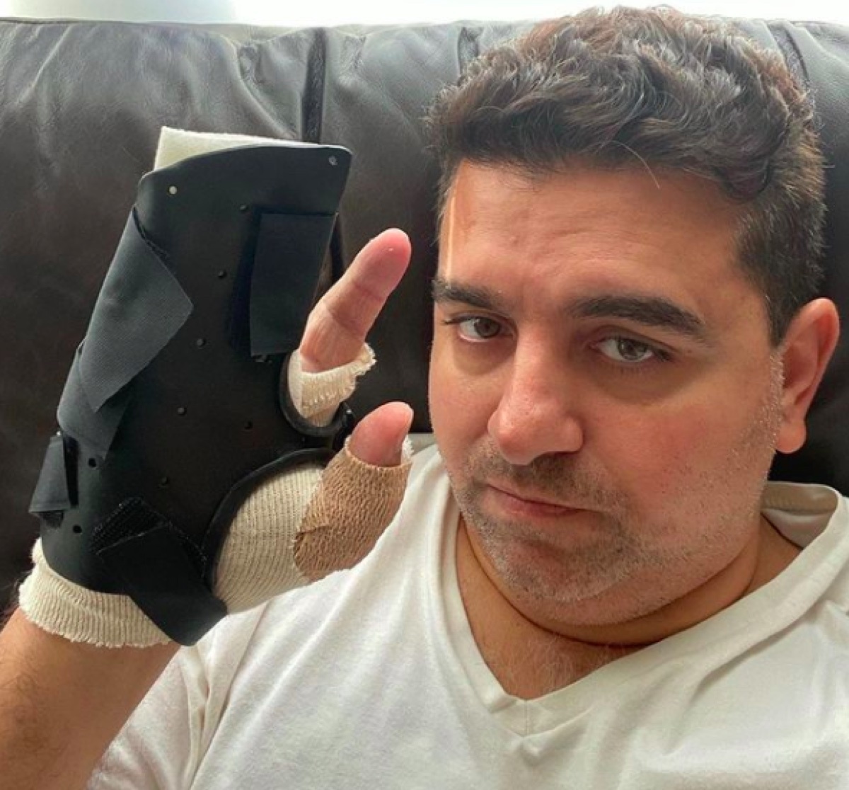 Buddy Valastro after third hand surgery