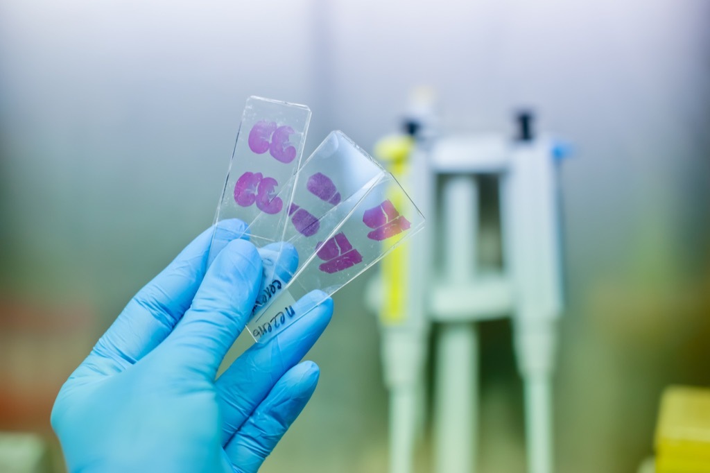 a doctor holding liver samples