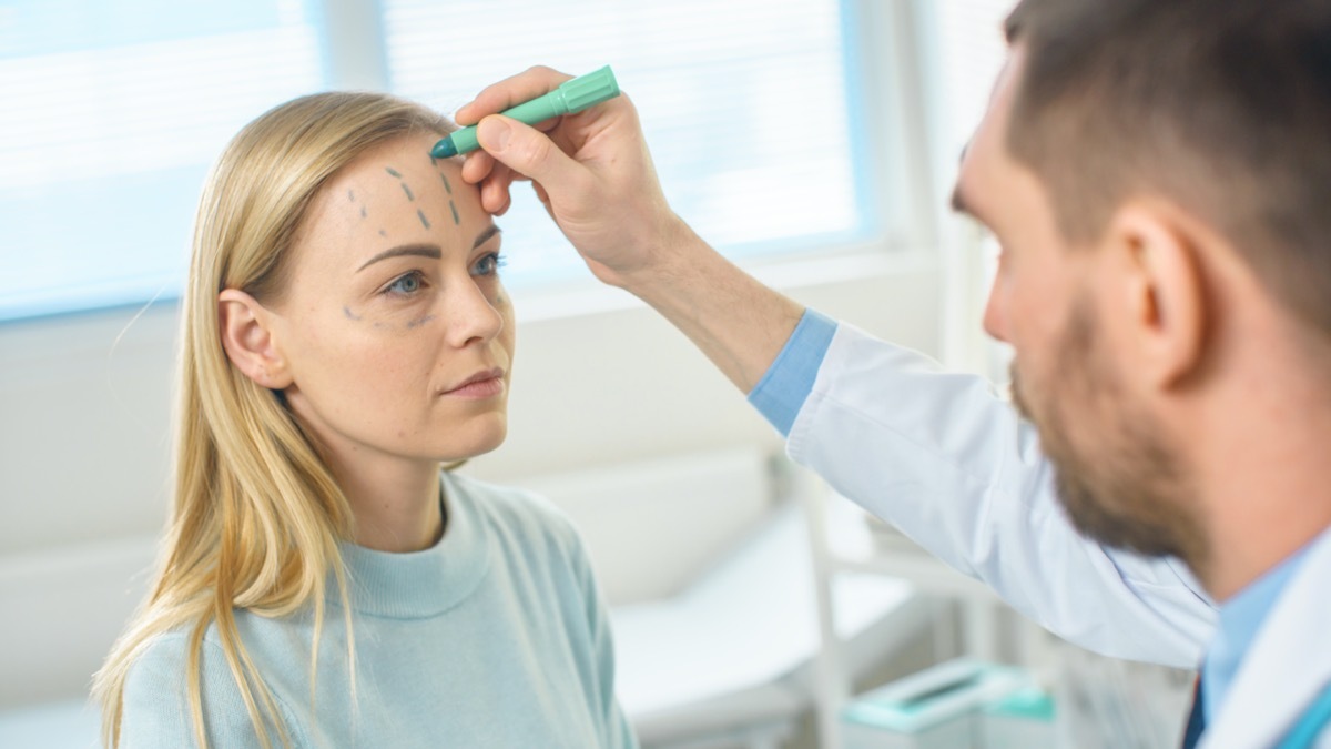 surgeon draws on a woman's face before a facelift