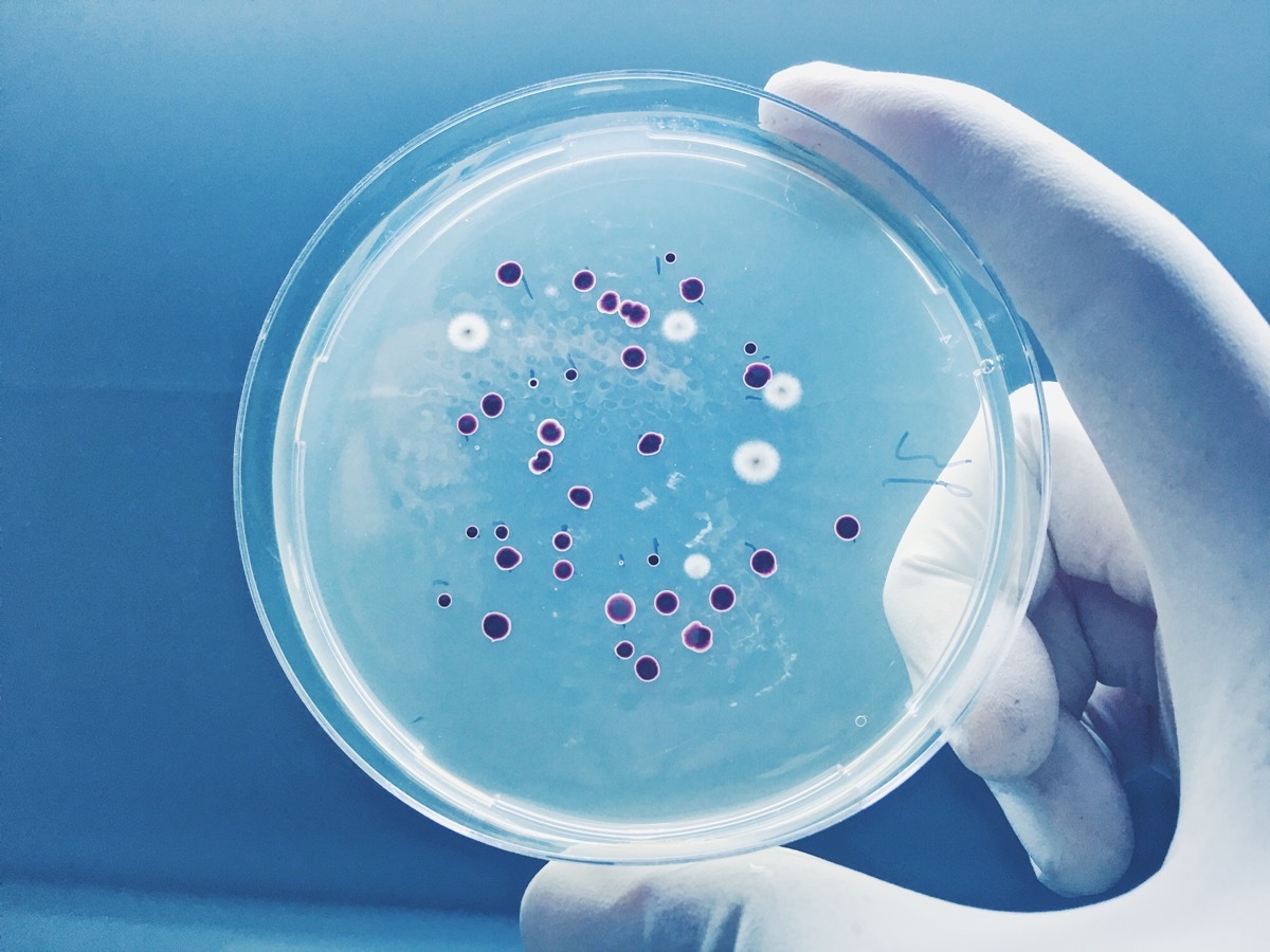 Agar plate full of micro bacterias and microorganisms